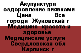 Акупунктура, оздоровление пиявками › Цена ­ 3 000 - Все города, Жуковский г. Медицина, красота и здоровье » Медицинские услуги   . Свердловская обл.,Карпинск г.
